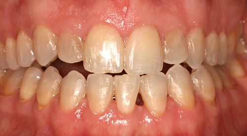 After 6MS at Hoddesdon Dental