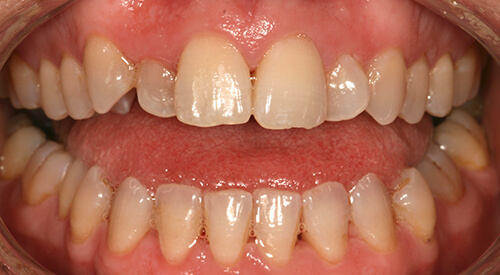 Before 6MS at Hoddesdon Dental