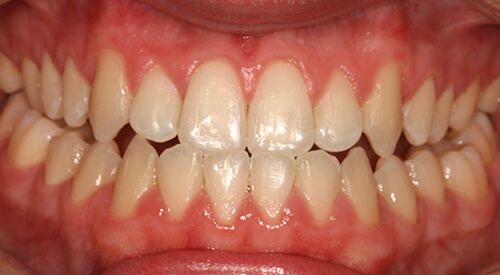 Post 6MS at Hoddesdon Dental