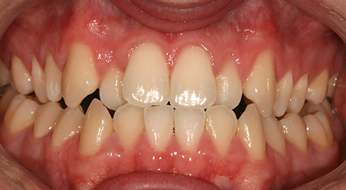 Pre 6MS at Hoddesdon Dental