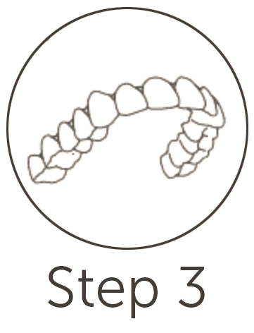 Invisalign Step 3