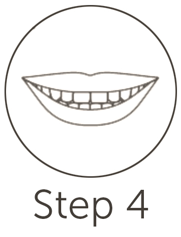 Invisalign Step 4